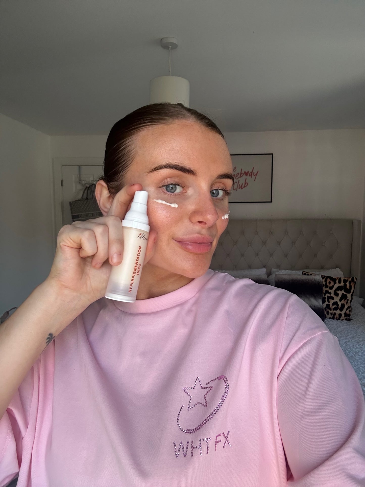 Hyperpigmentation Hero